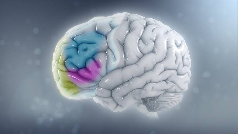 Brain of a child with ADHD with overall reduced volume and a proportional reduction in the left-sided prefrontal cortex. https://www.scientificanimations.com Creative Commons Attribution-Share Alike 4.0 International license. File:ADHD.jpg - Wikimedia Commons commons.wikimedia.org