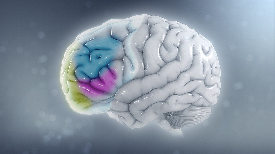Brain of a child with ADHD with overall reduced volume and a proportional reduction in the left-sided prefrontal cortex. https://www.scientificanimations.com Creative Commons Attribution-Share Alike 4.0 International license. File:ADHD.jpg - Wikimedia Commons commons.wikimedia.org